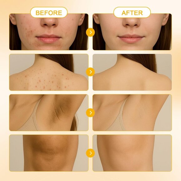 Turmeric Soap for Spots Remover - Honey Lemon Turmeric Kojic Soap Bar for Face a - Picture 6 of 9